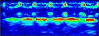 Máy dò khuyết tật siêu âm Huatec FD620 Bscan màu
